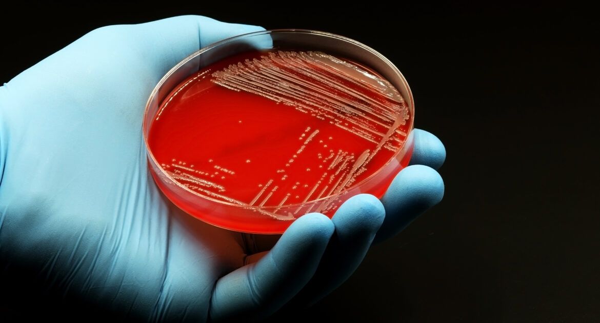 Doctor's or scientist's glove with a Petri dish with Agar Blood medium with a culture of the bacteria Methicillin resistant Staphylococcus aureus (MRSA)